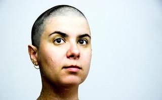 La chemioterapia e la caduta dei capelli