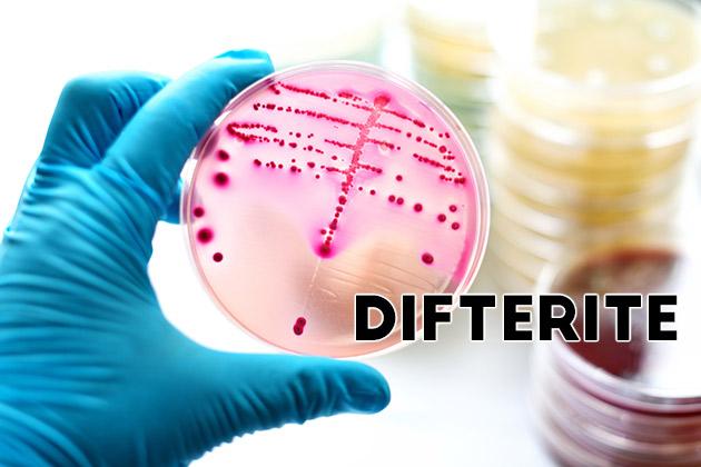 Difterite: una grave malattia infettiva